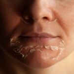 Follow these easy steps to combat your dry skin